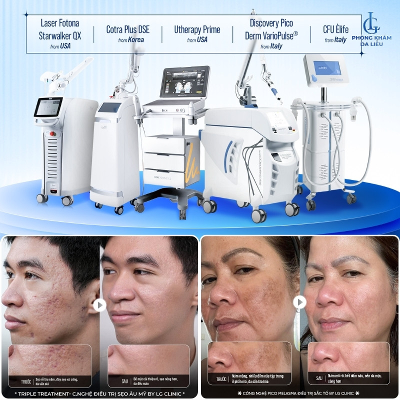 phòng khám da liễu gò vấp - lg clinic