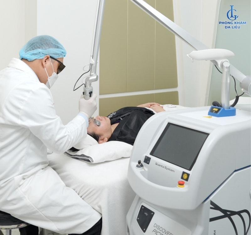 Laser trị tàn nhang