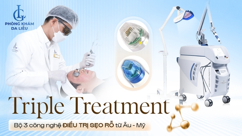 triple treatment điều trị sẹo rỗ