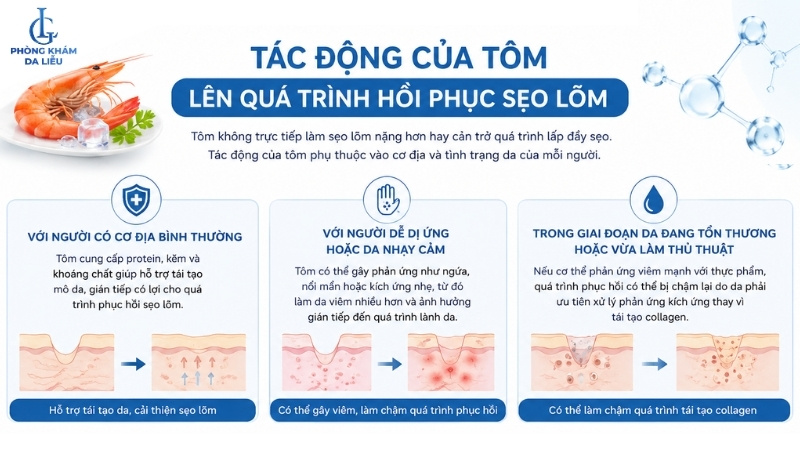 ăn tôm có bị sẹo lõm hay không