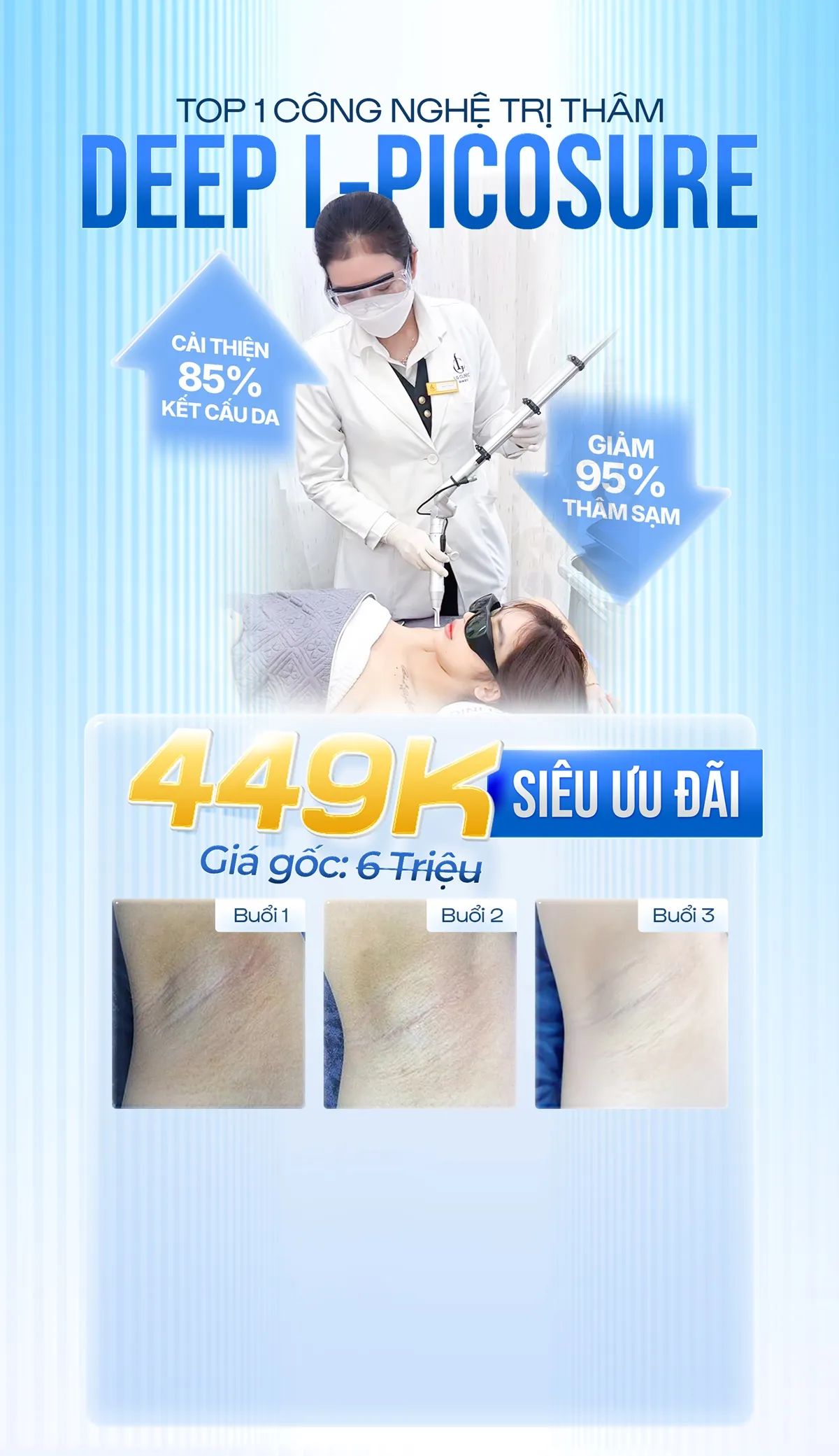 Banner công nghệ trị thâm deep l-picosure
