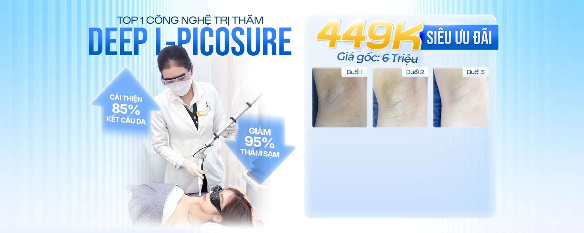 Banner công nghệ trị thâm deep l-picosure
