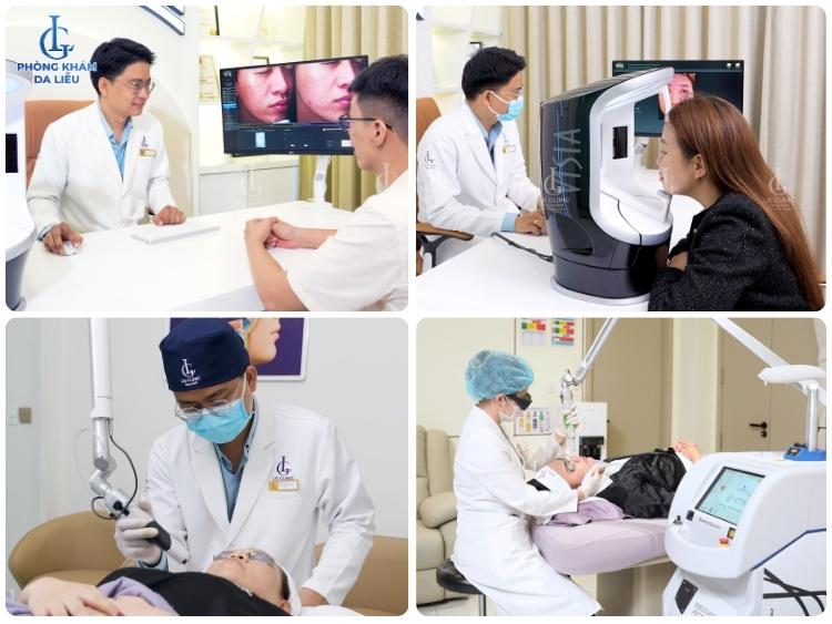 điều trị sẹo rỗ tại tphcm giá bao nhiêu