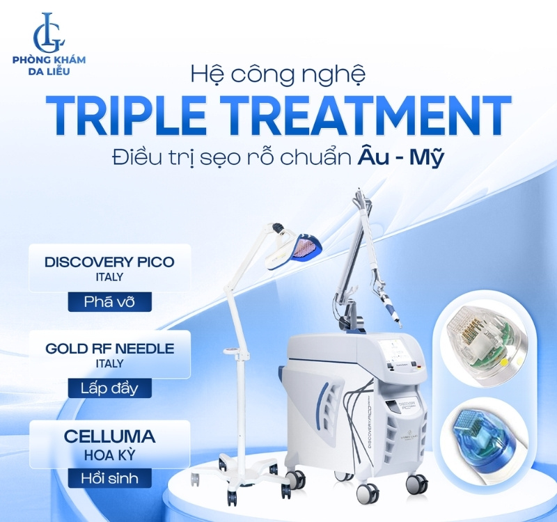 điều trị sẹo rỗ triple treatment