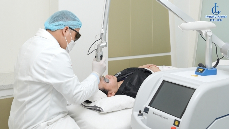 giá điều trị sẹo rỗ