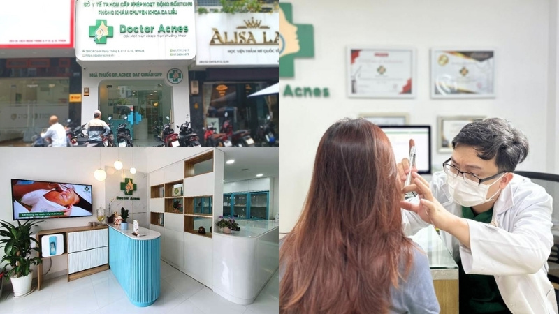 thẩm mỹ viện điều trị sẹo lõm doctor acnes