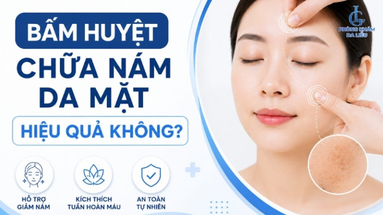 Bấm huyệt chữa nám da mặt hiệu quả không? Hướng dẫn từ chuyên gia