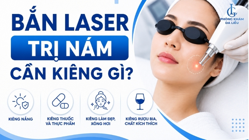 Bắn laser trị nám cần kiêng gì?