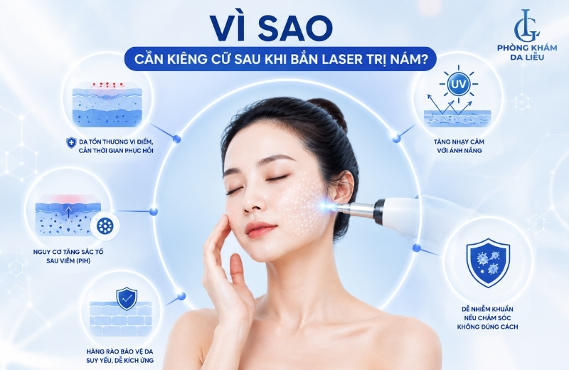 bắn laser trị nám cần kiêng gì