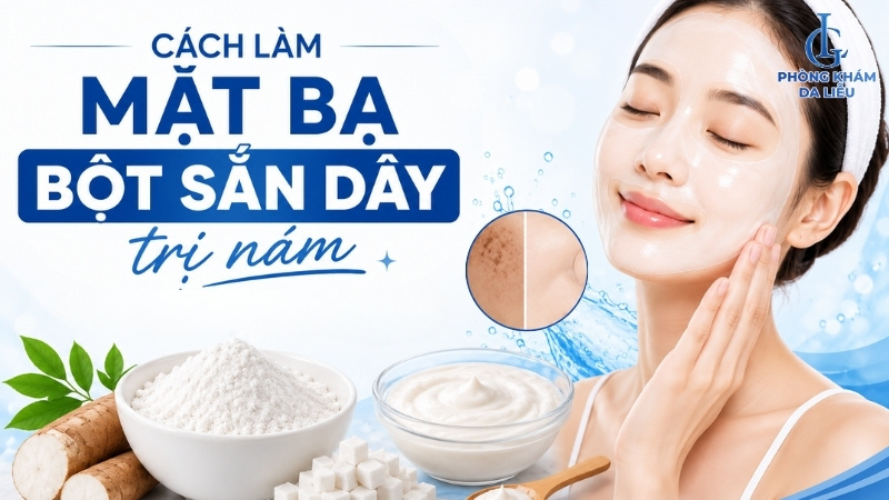 Cách làm mặt nạ bột sắn dây trị nám