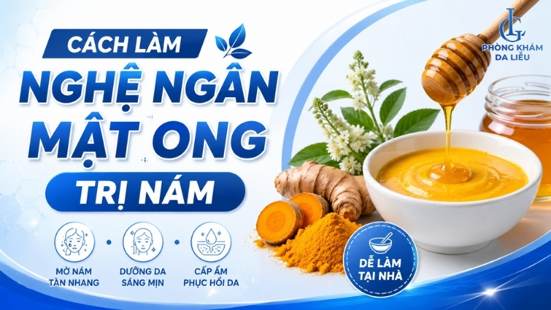Cách làm nghệ ngâm mật ong trị nám