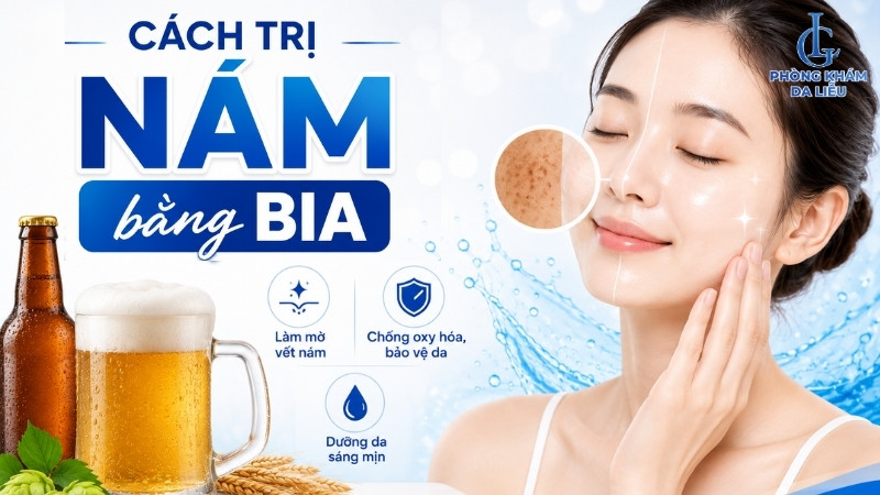 Cách trị nám bằng bia