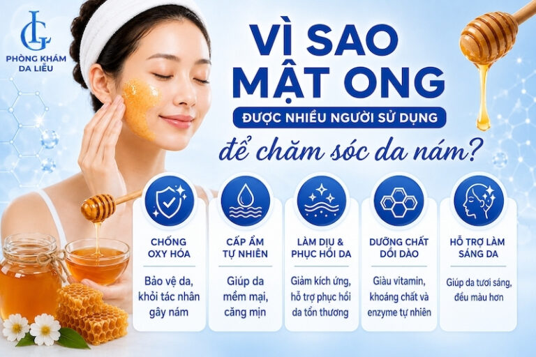 Cách trị nám bằng mật ong tại nhà: 5 công thức đơn giản dễ thực hiện