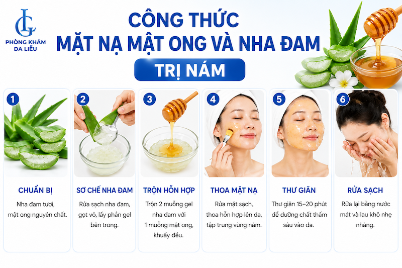 cách trị nám da bằng nha đam và mật ong