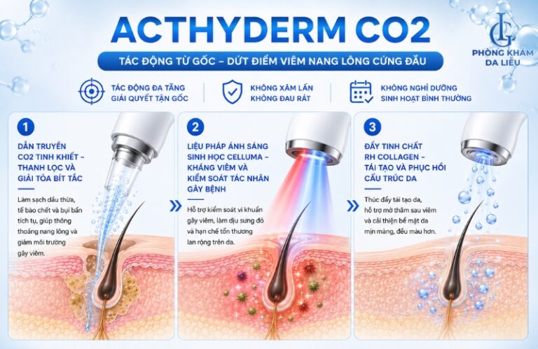 Điều trị viêm nang lông từ gốc không đau rát, không nghỉ dưỡng – Sạch viêm, giảm mụn, mờ thâm sau 1 liệu trình
