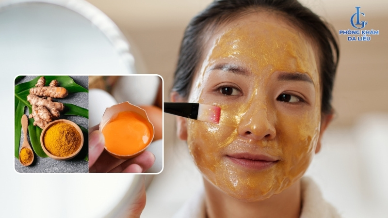 Mặt nạ trứng gà trị nám