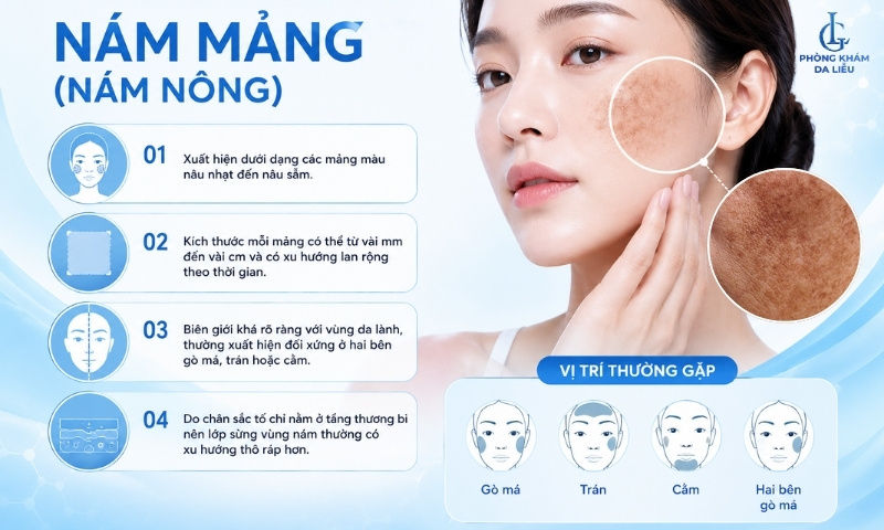 nám mảng