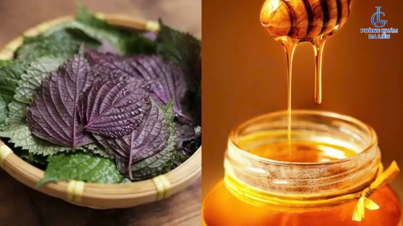 xông mặt bằng lá tía tô và mật ong