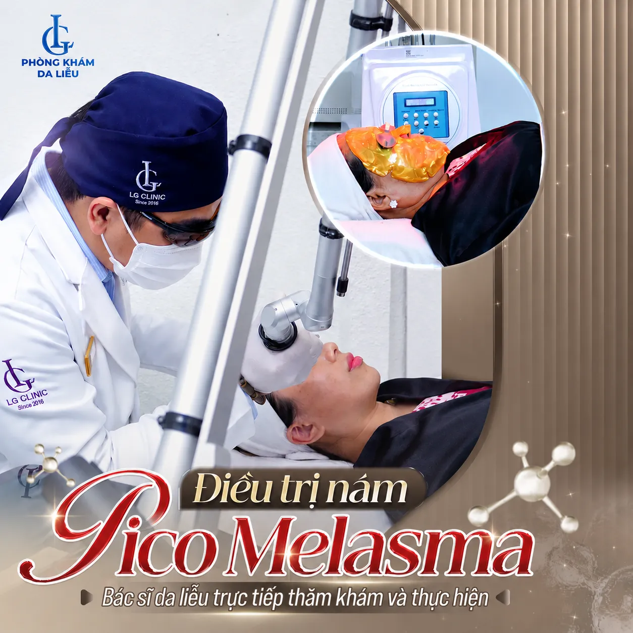 điều trị nám pico melasma