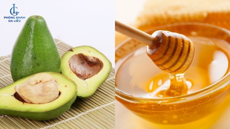 Mặt nạ bơ và mật ong hỗ trợ dưỡng ẩm, nuôi dưỡng làn da mềm mịn