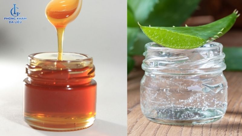 Cách trị nám bằng nha đam và mật ong