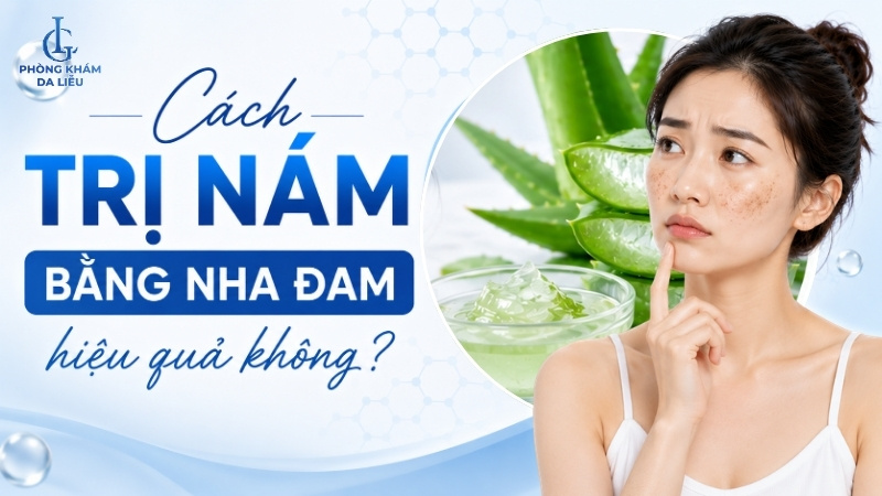 cách trị nám bằng nha đam
