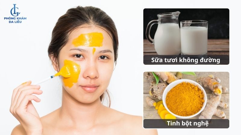 dùng tinh bột nghệ làm mặt nạ trị nám tàn nhang