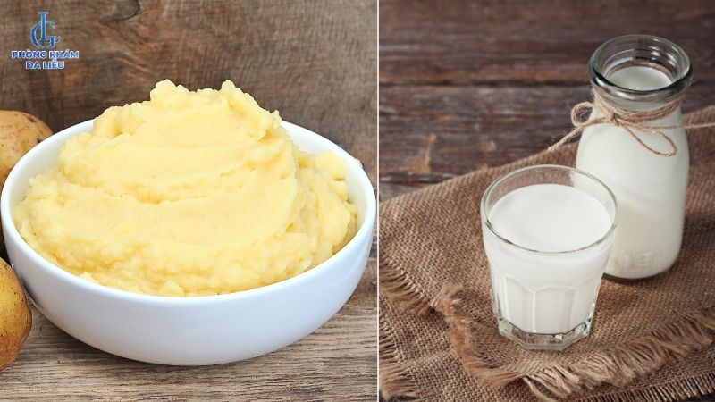 khoai tây và sữa tươi làm mặt nạ trị nám