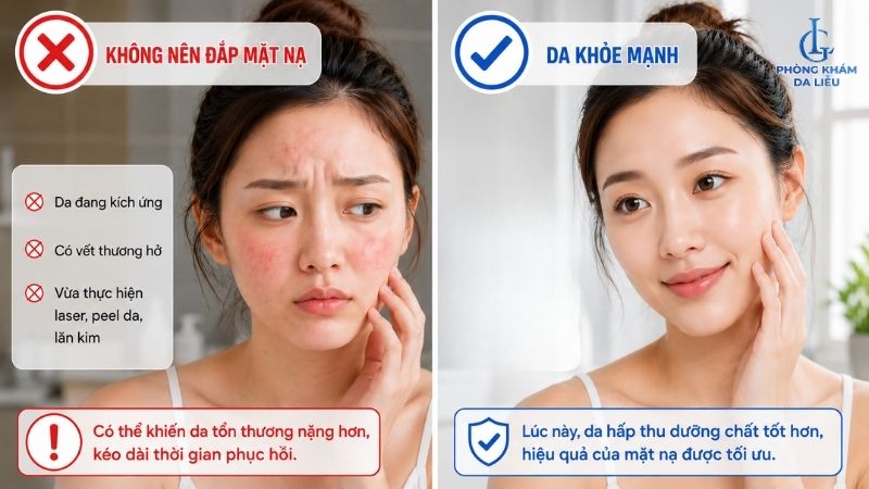 Lưu ý khi dùng mặt nạ chuối trị nám