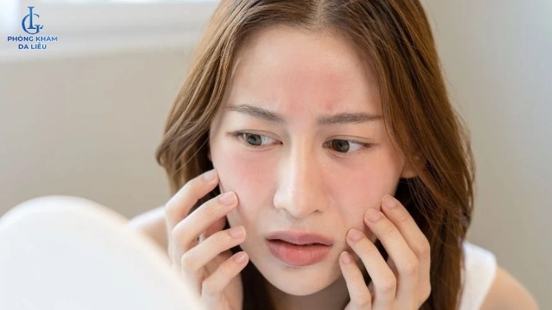 Da bị kích ứng
