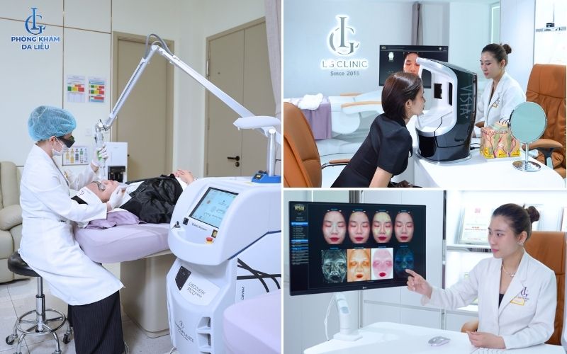 Điều trị nám da