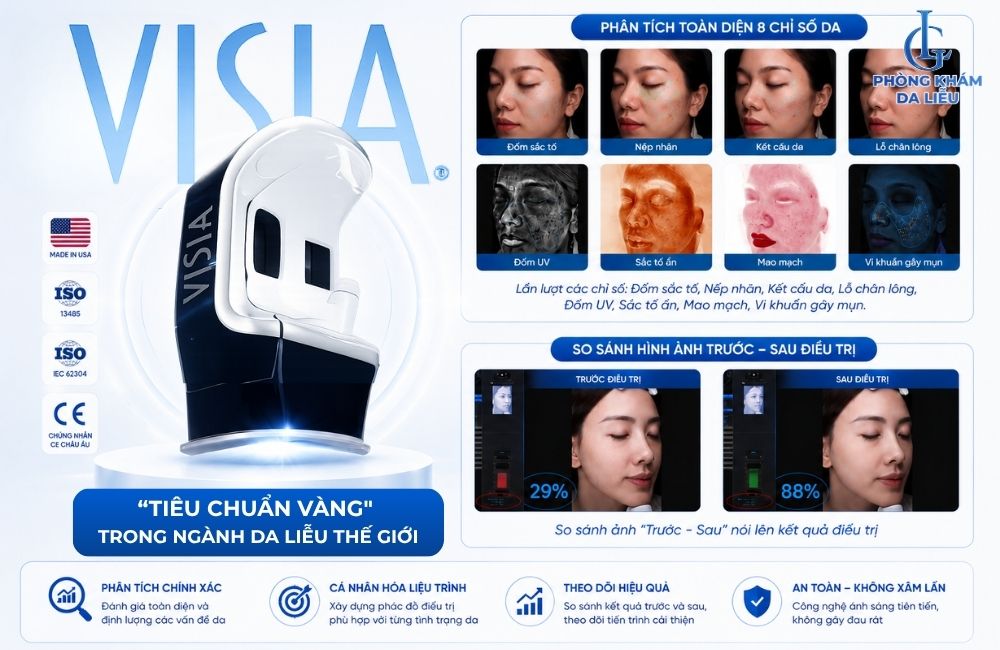Máy soi da Visia