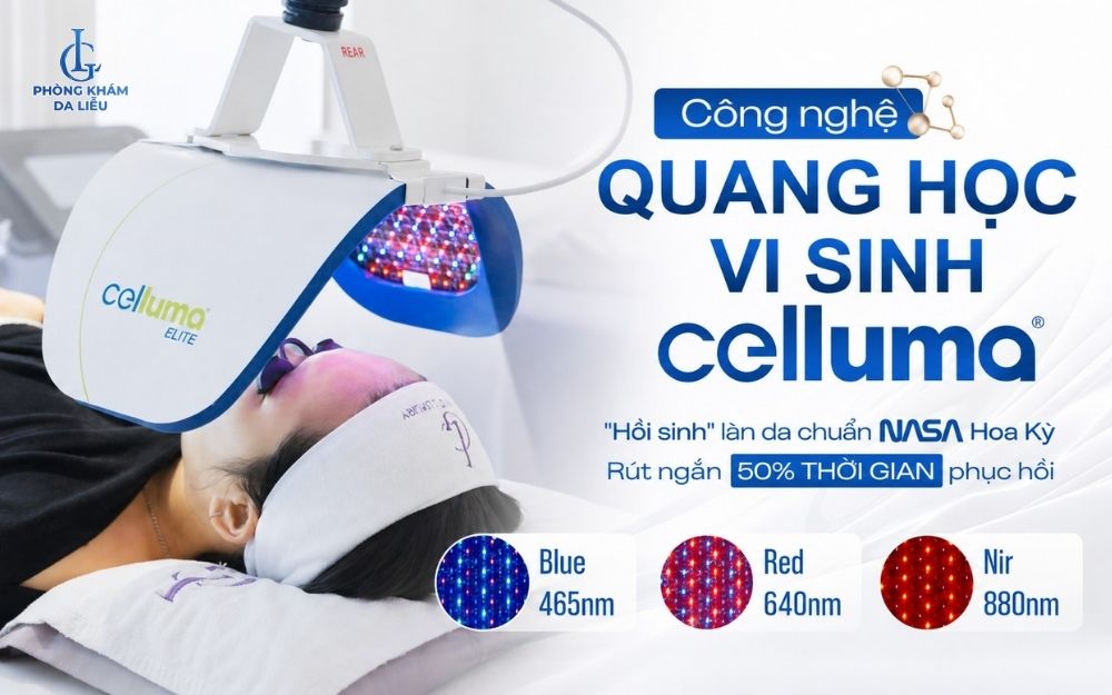 Đèn celluma trị mụn