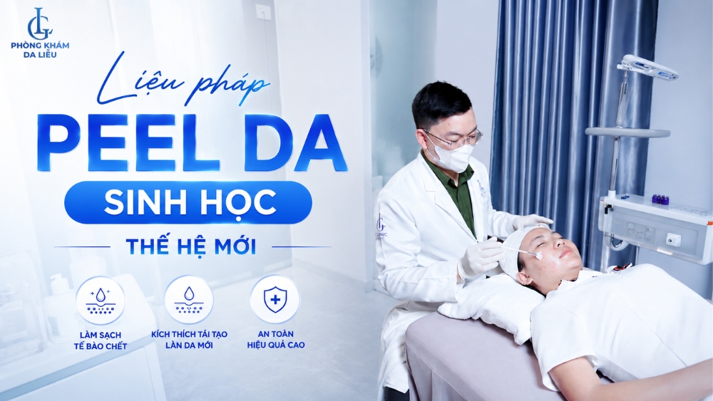 Peel da trị mụn