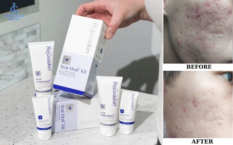 Kem trị sẹo rỗ Rejuvaskin Scar Esthetique