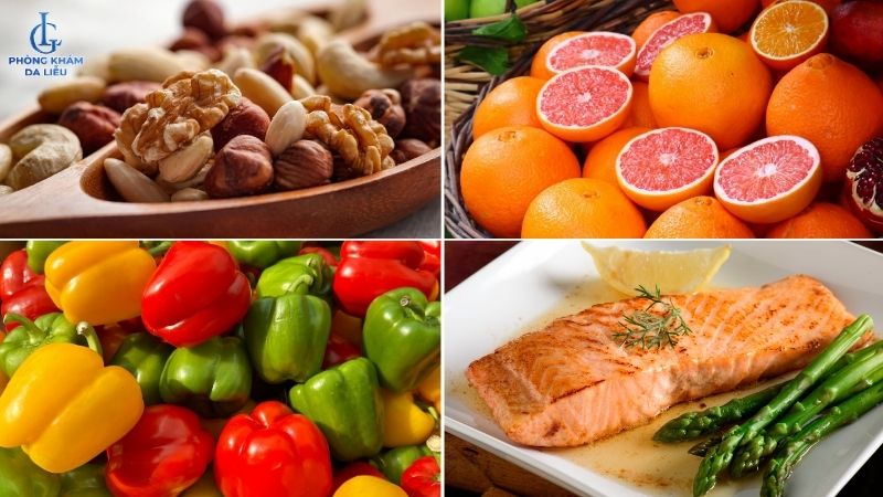 các thực phẩm nên ăn khi trị sẹo