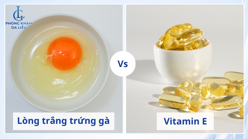 cách trị sẹo rỗ bằng trứng gà