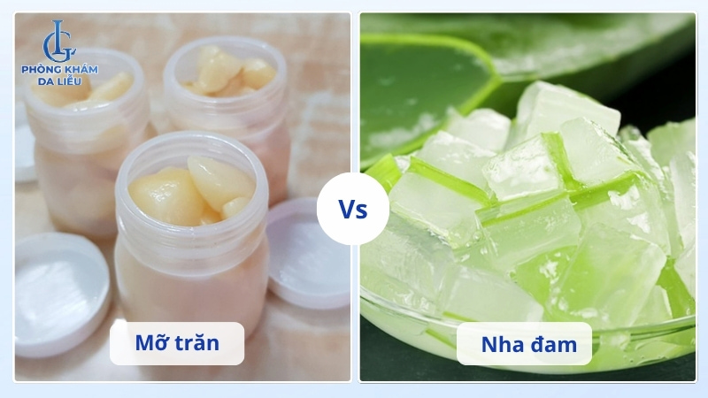 mỡ trăn kết hợp nha đam điều trị sẹo lõm