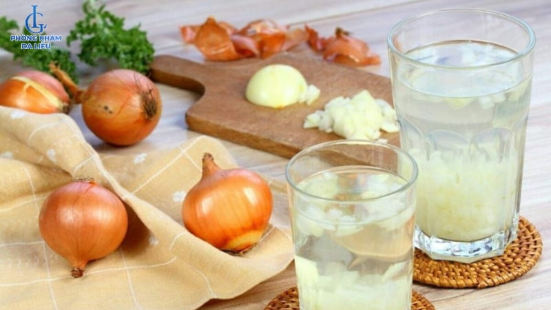 trị sẹo lõm bằng hành tây