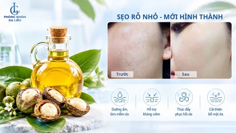 dầu mù u trị sẹo rỗ được không