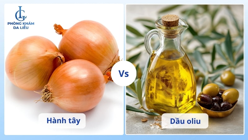 công thức từ hành tây giúp trị sẹo lõm