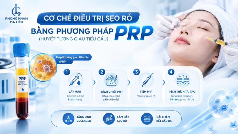 điều trị sẹo rỗ bằng prp