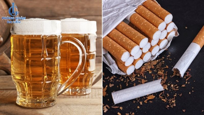 hạn chế chất kích thích khi trị sẹo rỗ