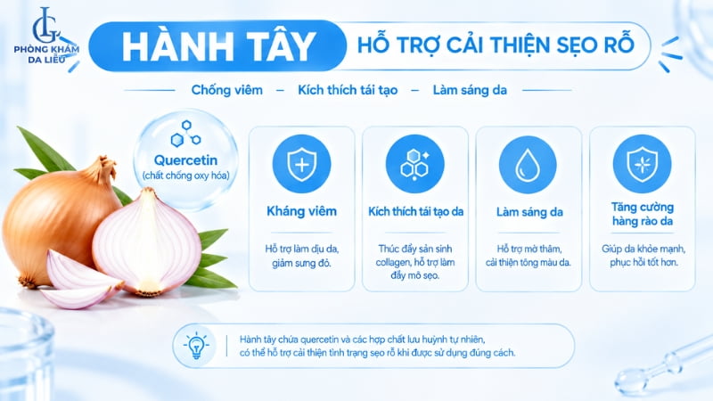 hành tây trị sẹo lõm
