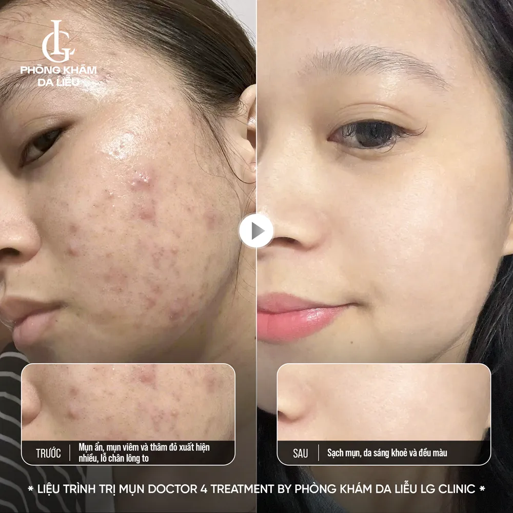 hình ảnh ba doctor 4 treatment