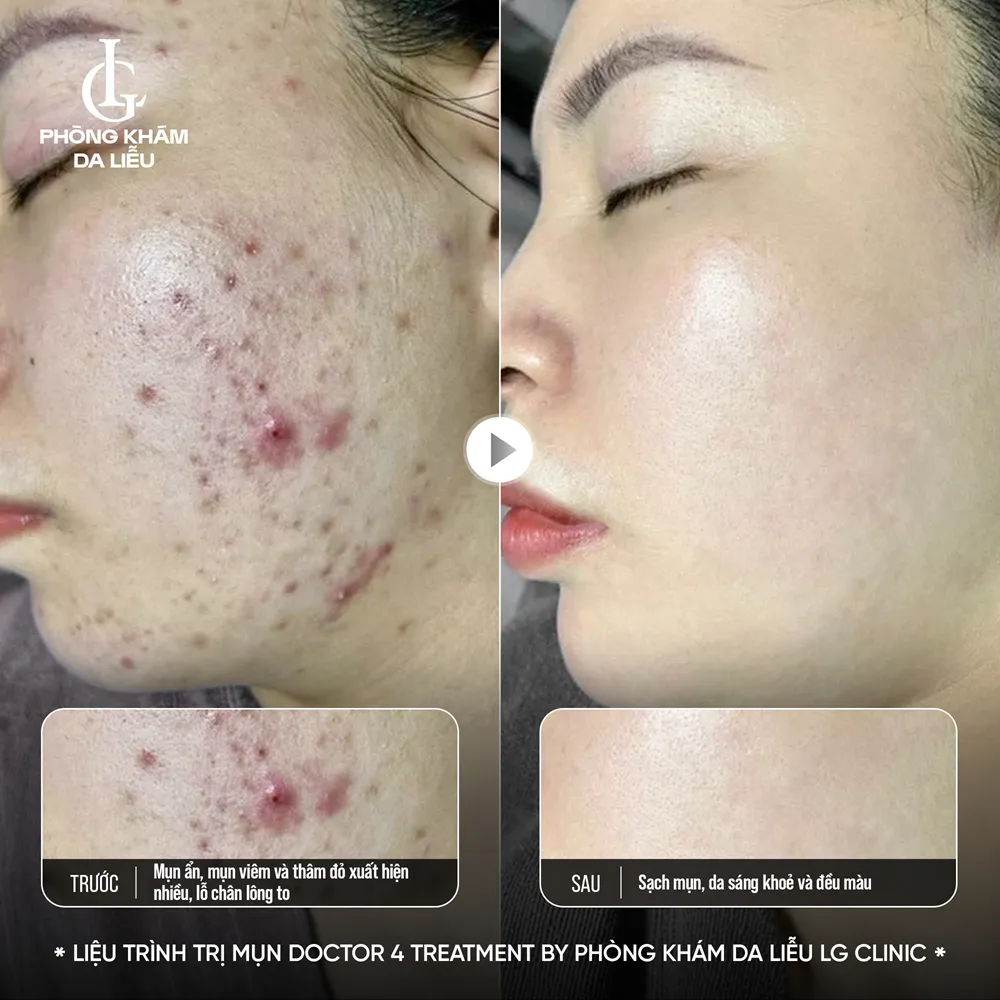 hình ảnh ba doctor 4 treatment
