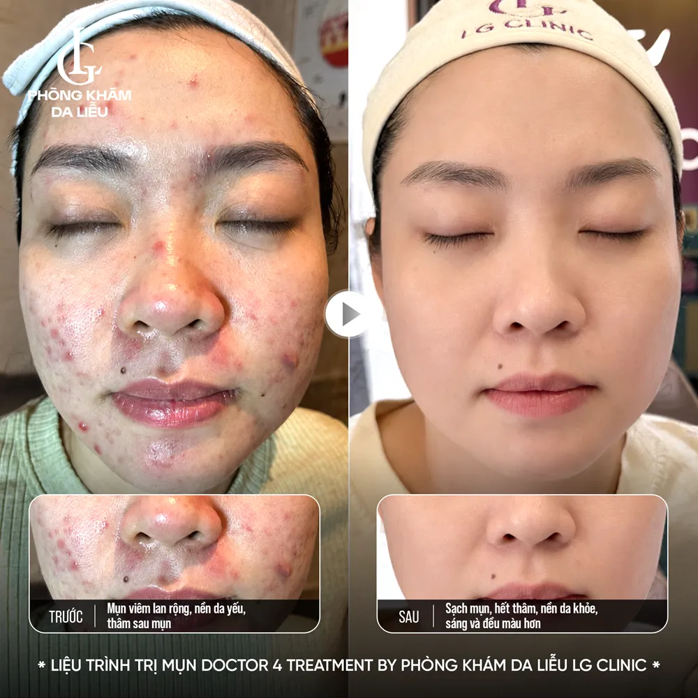 hình ảnh ba doctor 4 treatment