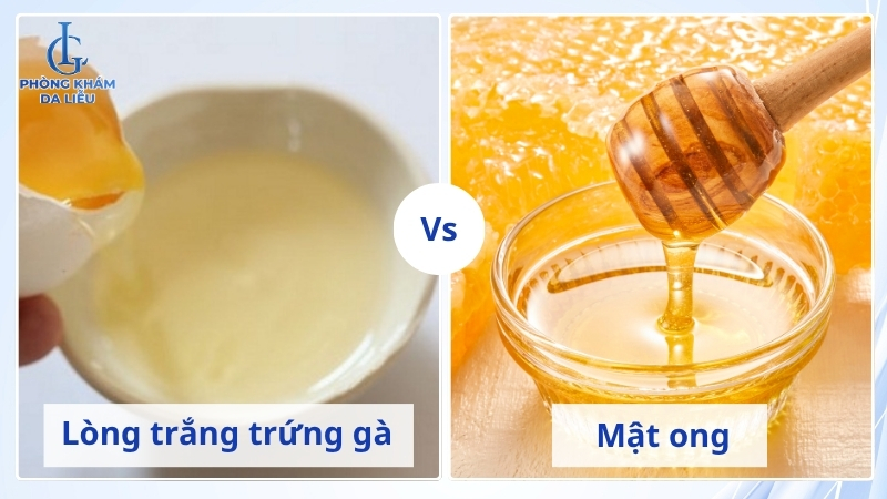 điều trị sẹo rỗ bằng trứng gà