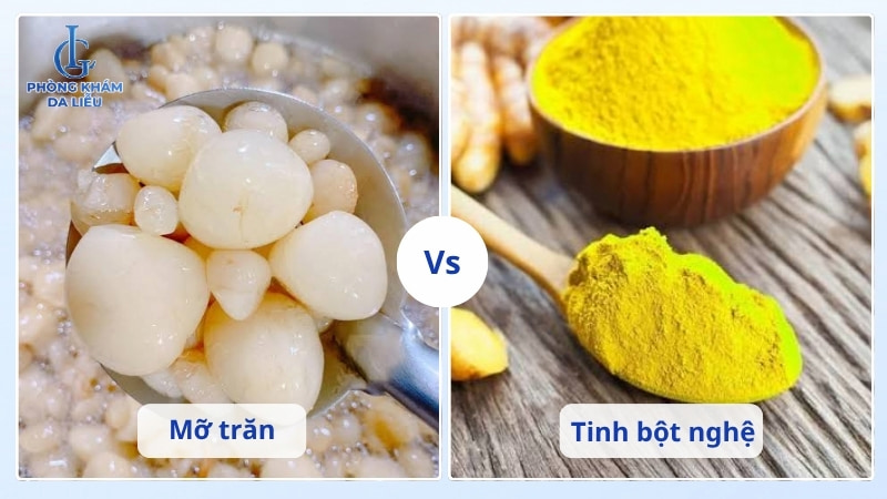 mỡ trăn kết hợp nghệ có trị sẹo lõm