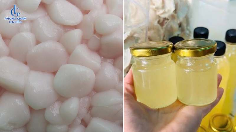 mỡ trăn trị sẹo lõm